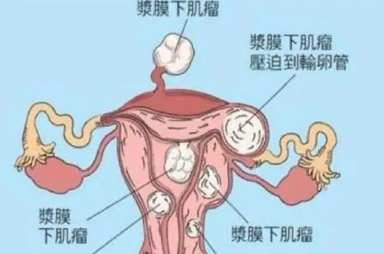 残角子宫能治愈吗做试管能成功吗？